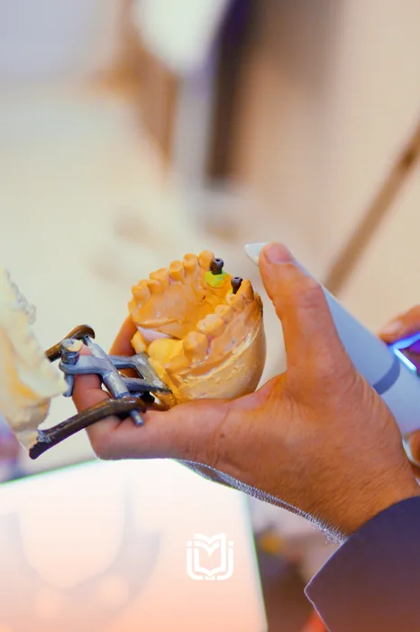 Holding a maxillary model with an implant abutment in place